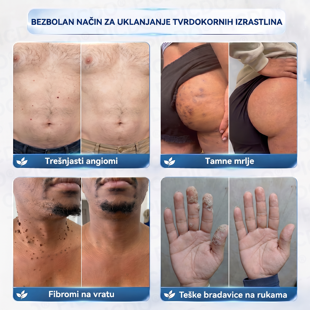 🎉✅𝐄𝐋𝐀𝐕𝐘𝐑𝐀® 𝐊𝐫𝐞𝐦𝐚 𝐙𝐚 𝐔𝐤𝐥𝐚𝐧𝐣𝐚𝐧𝐣𝐞 𝐊𝐨ž𝐧𝐢𝐡 𝐈𝐳𝐫𝐚𝐬𝐥𝐢𝐧𝐚 𝐈 𝐌𝐫𝐥𝐣𝐚 𝟕 𝐃𝐚𝐧𝐚 (𝐅𝐨𝐫𝐦𝐮𝐥𝐚 𝐛𝐞𝐳 𝐛𝐨𝐥𝐢 𝐢 𝐛𝐞𝐳 𝐨ž𝐢𝐥𝐣𝐚𝐤𝐚)