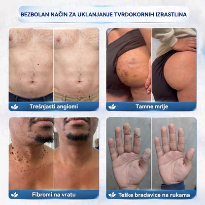 🎉✅𝐄𝐋𝐀𝐕𝐘𝐑𝐀® 𝐊𝐫𝐞𝐦𝐚 𝐙𝐚 𝐔𝐤𝐥𝐚𝐧𝐣𝐚𝐧𝐣𝐞 𝐊𝐨ž𝐧𝐢𝐡 𝐈𝐳𝐫𝐚𝐬𝐥𝐢𝐧𝐚 𝐈 𝐌𝐫𝐥𝐣𝐚 𝟕 𝐃𝐚𝐧𝐚 (𝐅𝐨𝐫𝐦𝐮𝐥𝐚 𝐛𝐞𝐳 𝐛𝐨𝐥𝐢 𝐢 𝐛𝐞𝐳 𝐨ž𝐢𝐥𝐣𝐚𝐤𝐚)