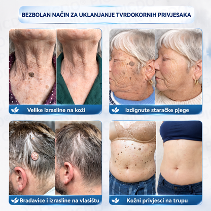 🎉✅𝐄𝐋𝐀𝐕𝐘𝐑𝐀® 𝐊𝐫𝐞𝐦𝐚 𝐙𝐚 𝐔𝐤𝐥𝐚𝐧𝐣𝐚𝐧𝐣𝐞 𝐊𝐨ž𝐧𝐢𝐡 𝐈𝐳𝐫𝐚𝐬𝐥𝐢𝐧𝐚 𝐈 𝐌𝐫𝐥𝐣𝐚 𝟕 𝐃𝐚𝐧𝐚 (𝐅𝐨𝐫𝐦𝐮𝐥𝐚 𝐛𝐞𝐳 𝐛𝐨𝐥𝐢 𝐢 𝐛𝐞𝐳 𝐨ž𝐢𝐥𝐣𝐚𝐤𝐚)