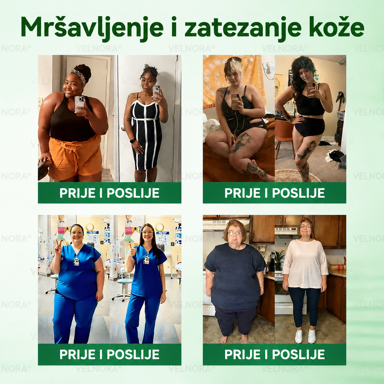 🎉🎁 Službena trgovina | 𝐕𝐄𝐋𝐍𝐎𝐑𝐀® Moringa & Berberin 10-u-1 napredni flaster s nano-mikroiglicama (samo jednom dnevno, primjetne promjene u samo 7 dana)
