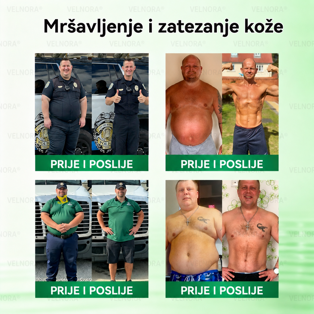 🎉🎁 Službena trgovina | 𝐕𝐄𝐋𝐍𝐎𝐑𝐀® Moringa & Berberin 10-u-1 napredni flaster s nano-mikroiglicama (samo jednom dnevno, primjetne promjene u samo 7 dana)
