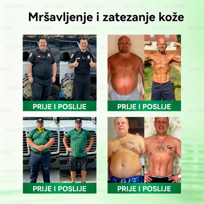🎉🎁 Službena trgovina | 𝐕𝐄𝐋𝐍𝐎𝐑𝐀® Moringa & Berberin 10-u-1 napredni flaster s nano-mikroiglicama (samo jednom dnevno, primjetne promjene u samo 7 dana)