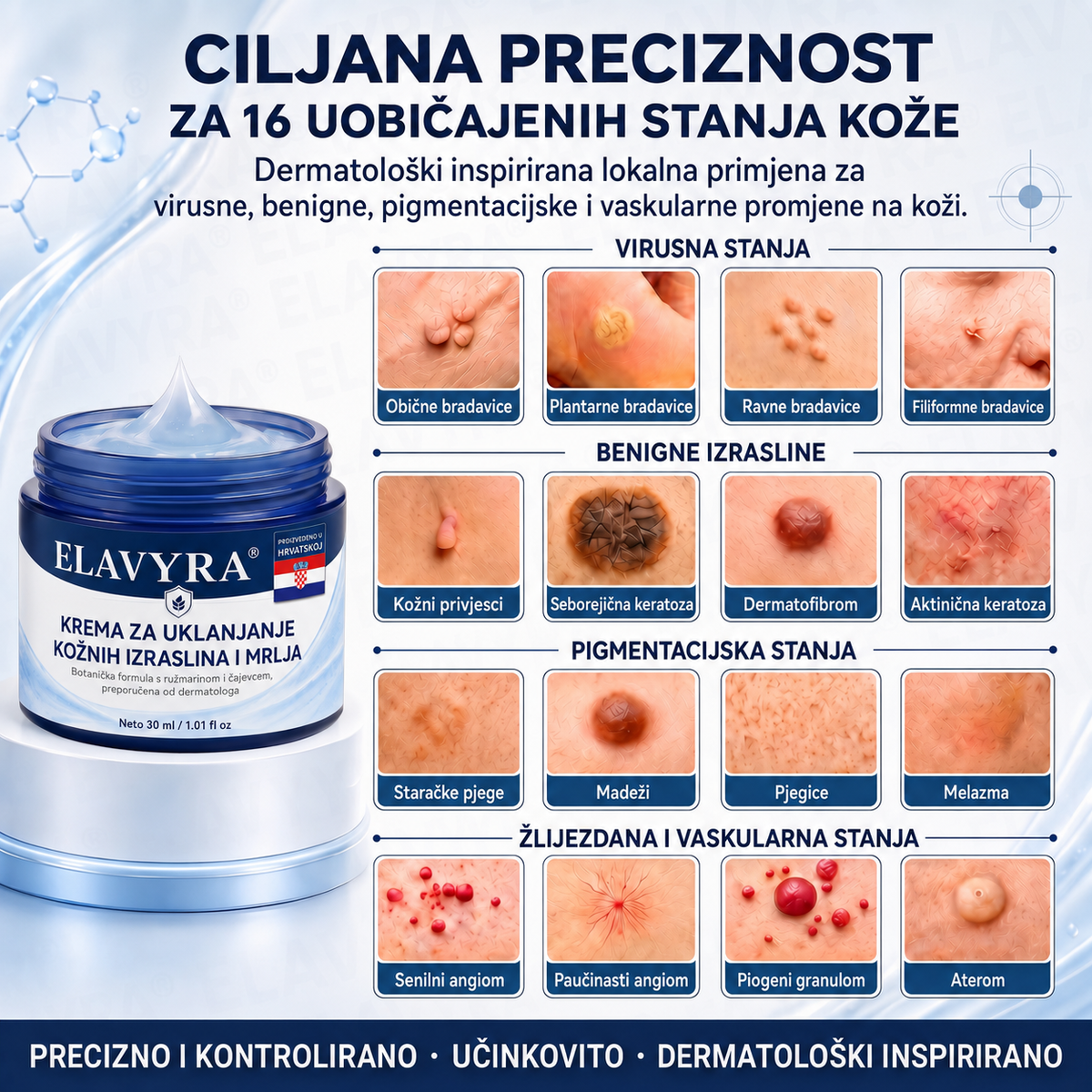 🎉✅𝐄𝐋𝐀𝐕𝐘𝐑𝐀® 𝐊𝐫𝐞𝐦𝐚 𝐙𝐚 𝐔𝐤𝐥𝐚𝐧𝐣𝐚𝐧𝐣𝐞 𝐊𝐨ž𝐧𝐢𝐡 𝐈𝐳𝐫𝐚𝐬𝐥𝐢𝐧𝐚 𝐈 𝐌𝐫𝐥𝐣𝐚 𝟕 𝐃𝐚𝐧𝐚 (𝐅𝐨𝐫𝐦𝐮𝐥𝐚 𝐛𝐞𝐳 𝐛𝐨𝐥𝐢 𝐢 𝐛𝐞𝐳 𝐨ž𝐢𝐥𝐣𝐚𝐤𝐚)