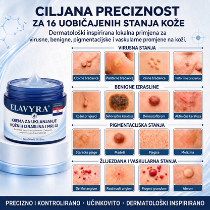 🎉✅𝐄𝐋𝐀𝐕𝐘𝐑𝐀® 𝐊𝐫𝐞𝐦𝐚 𝐙𝐚 𝐔𝐤𝐥𝐚𝐧𝐣𝐚𝐧𝐣𝐞 𝐊𝐨ž𝐧𝐢𝐡 𝐈𝐳𝐫𝐚𝐬𝐥𝐢𝐧𝐚 𝐈 𝐌𝐫𝐥𝐣𝐚 𝟕 𝐃𝐚𝐧𝐚 (𝐅𝐨𝐫𝐦𝐮𝐥𝐚 𝐛𝐞𝐳 𝐛𝐨𝐥𝐢 𝐢 𝐛𝐞𝐳 𝐨ž𝐢𝐥𝐣𝐚𝐤𝐚)